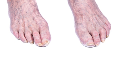 How Feet Change with Age