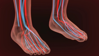 Can Poor Foot Circulation Be Improved?